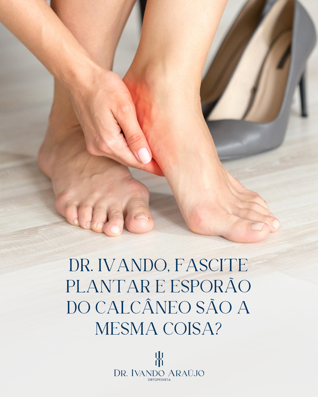 Fascite plantar e esporão do calcâneo são a mesma coisa? - Dr. Ivando ...